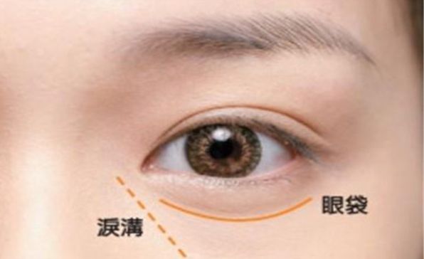 深圳哪家醫(yī)院割雙眼皮技術(shù)獨(dú)步全球？高水平專家團(tuán)隊(duì)助力