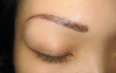 上海伯思立王艷隆鼻效果怎么樣？肋軟骨隆鼻真實案例及收費一覽