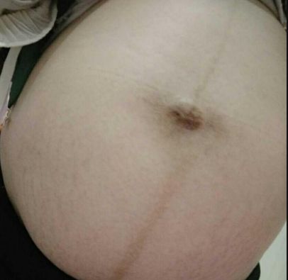 揭示濰坊市熱門(mén)隆鼻醫(yī)院排行榜！尋找濰坊隆鼻首選醫(yī)療機(jī)構(gòu)TOP10！