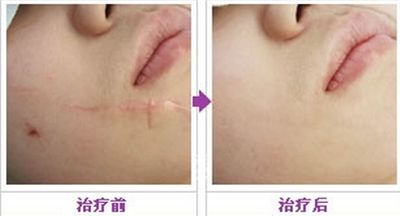 重慶神奇醫(yī)療機(jī)構(gòu)，致力于脂肪填充醫(yī)療服務(wù)的機(jī)構(gòu)盤點(diǎn)