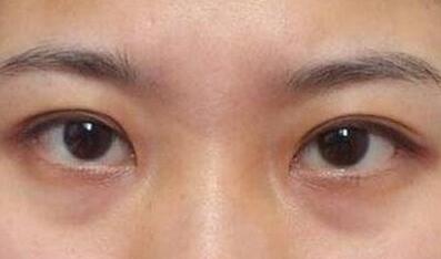 杭州東方整形吸脂到底值不值得嘗試？