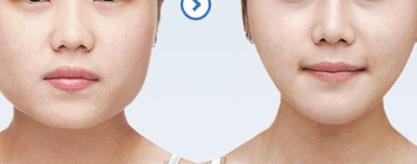 461醫(yī)院植牙科綜合評測：醫(yī)生隊伍強大，成功案例豐富，價格表詳解