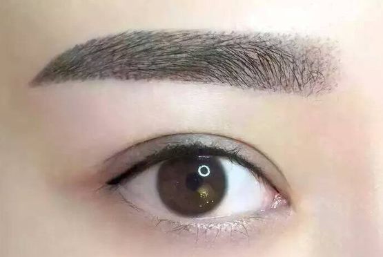 徐州二院美容科雙眼皮手術(shù)陶常波醫(yī)生介紹及成功案例分析