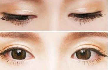 青島壹美天成整形醫(yī)院的隆鼻技術(shù)如何？看看這些真實(shí)案例！