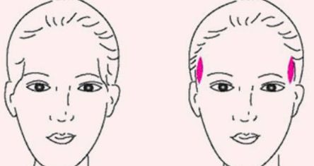 成都軍大醫(yī)院外切眼袋手術(shù)效果及評(píng)價(jià)分析