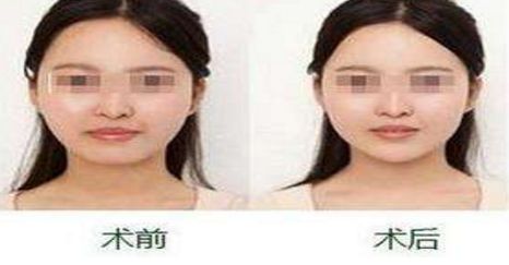 揚州隆胸專家2024榜單評選揭曉：挑選胸部整形領(lǐng)域翹楚！