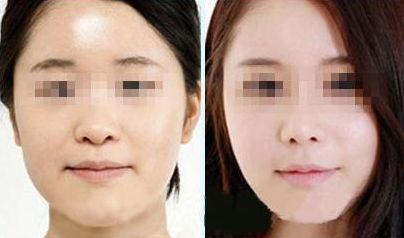 優(yōu)質(zhì)修復(fù)妊娠紋服務(wù)中心推薦