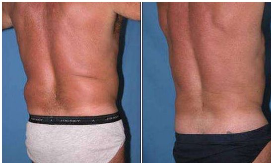 成都隆鼻專家推薦的技術排名前十，絕對讓你滿意