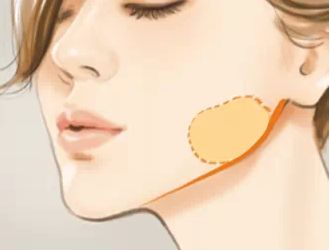 成都優(yōu)秀的脂肪抽吸醫(yī)院名單大揭秘