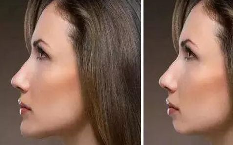 重慶地區(qū)哪家整容醫(yī)院聲譽(yù)良好，新版排行榜公布，等你來(lái)挑選