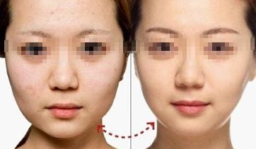 鄭州專業(yè)吸脂醫(yī)生推薦，口碑技術(shù)實力兼具！