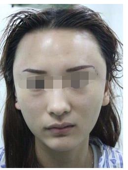 浙江地區(qū)有哪些知名鼻部整形私立醫(yī)院？