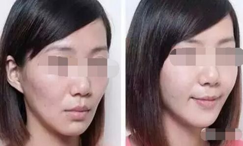 北京哪些醫(yī)院能進行吸脂手術(shù)？