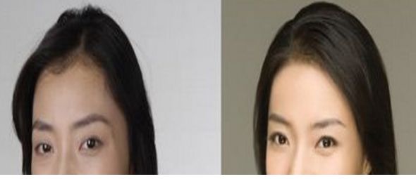 成都悅己醫(yī)美醫(yī)生實力強，顧客口碑好價格合適