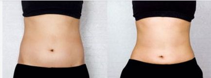 北京大學醫(yī)院眼部整形怎么樣？真實案例分享+醫(yī)生介紹