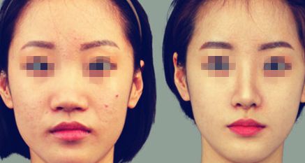 北京亞運村醫(yī)院皮膚美容科實力加盟，優(yōu)勢診療項目全解析