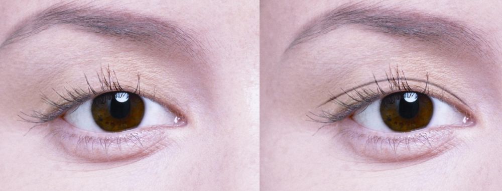 鄭州市那家醫(yī)院割雙眼皮效果好，口碑贊不絕口！