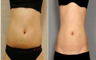 成都哪家醫(yī)院適合做光子嫩膚？排名前五的醫(yī)美機(jī)構(gòu)推薦！