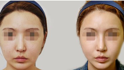 深圳七和醫(yī)美口碑如何？技術實力+醫(yī)生團隊+特色項目解析