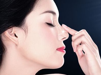 深圳隆鼻哪家好？易培金醫(yī)生經(jīng)驗(yàn)口碑解析測評(píng)