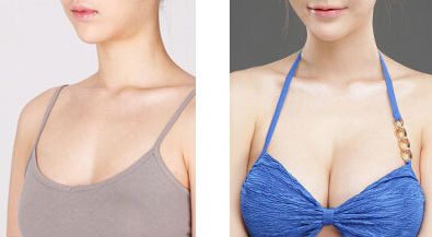 蘇州磨骨整形醫(yī)院排名最前十的綜合評(píng)價(jià)揭曉