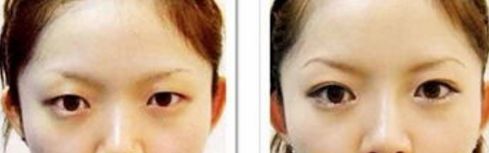 天津有沒有靠譜的去皺美容醫(yī)院？