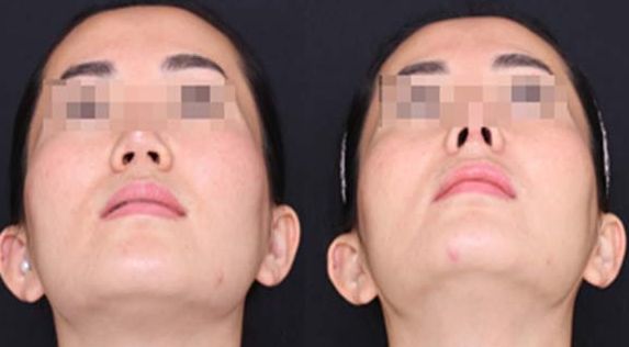 蘭州經(jīng)驗豐富的脂肪豐胸醫(yī)生推薦：逯巖、郭曉磊、雷蓓