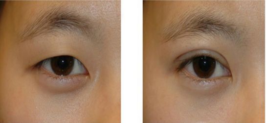 武漢最好的整形美容醫(yī)院哪家？