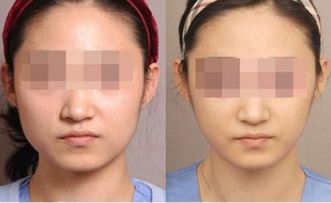 湛江有哪些頂尖整形美容醫(yī)院值得關(guān)注？