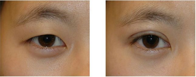 上海當?shù)蒯t(yī)院哪些更受歡迎