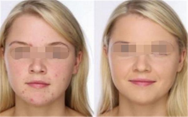 2024年樂山哪家正畸醫(yī)院技術(shù)排名靠前？