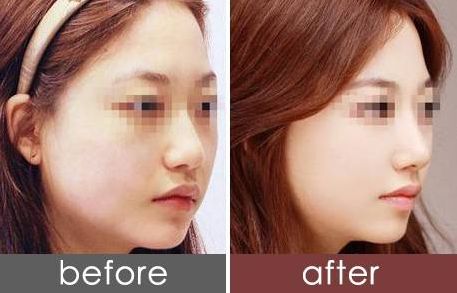 貴陽地區(qū)哪些醫(yī)院專業(yè)提供整形美容服務(wù)