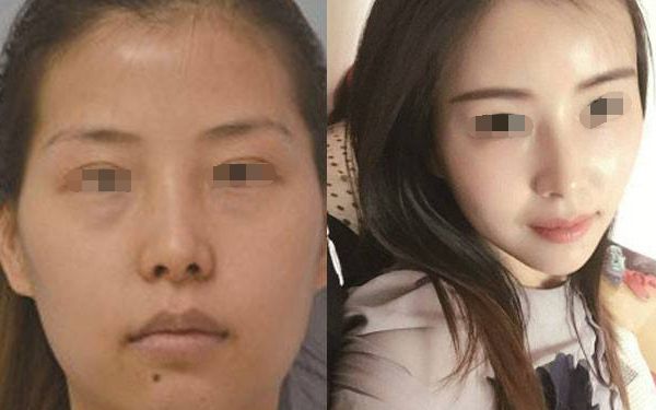 松原市哪家整形醫(yī)院效果好？