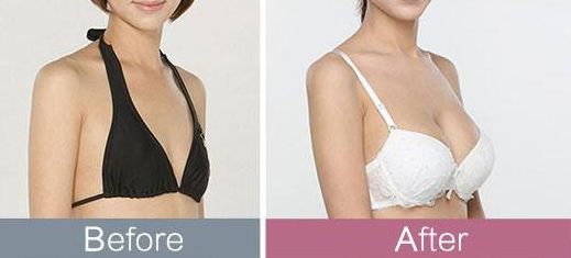 東莞哪家整形醫(yī)院頗受推薦？