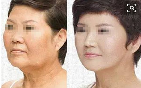 揭秘鄭州鼻修復(fù)名家，一覽權(quán)威醫(yī)生陣容