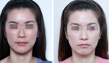 煙臺(tái)整形醫(yī)院前五強(qiáng)詳評(píng)：優(yōu)勢(shì)特色大比拼