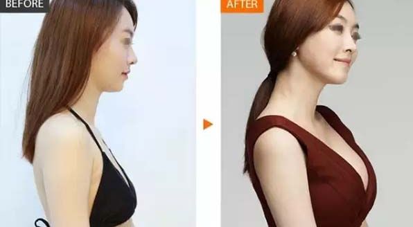 長沙哪家雙眼皮醫(yī)院排名靠前呢？