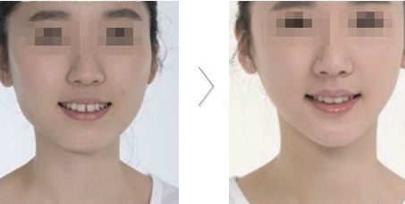 哪家醫(yī)院在北京具有卓越的醫(yī)美科技和服務(wù)？歐洲醫(yī)學(xué)中心、北京協(xié)和、北大人民醫(yī)院等公立單位有何特色？