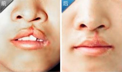 福州整形醫(yī)院2024匯總報(bào)告出爐，重磅推薦！