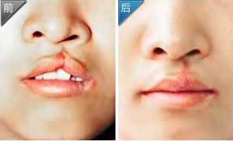 雅典娜美容診所價(jià)目公布及醫(yī)生簡(jiǎn)介【更新】