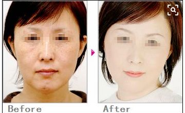 常州市前五名正規(guī)整形醫(yī)院排名及綜合評(píng)價(jià)