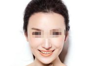 廈門注射隆鼻醫(yī)院優(yōu)質(zhì)匯總