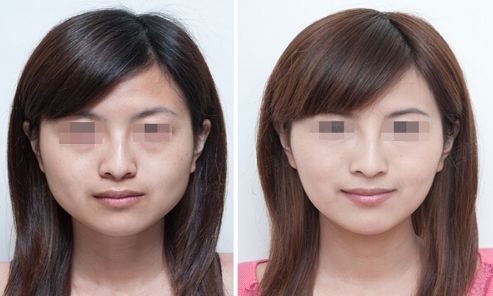 煙臺(tái)市三甲整形醫(yī)院排名匯總，哪家好？