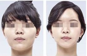 無錫坤如瑪麗整形美容醫(yī)院的醫(yī)生團(tuán)隊(duì)簡介，專家力量強(qiáng)大