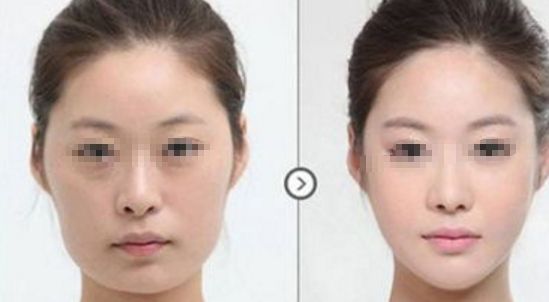 長春鼻整形哪所醫(yī)院靠譜