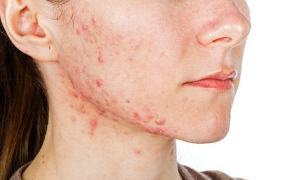 菏澤市立醫(yī)院整形外科：讓你美麗蛻變的秘密揭秘