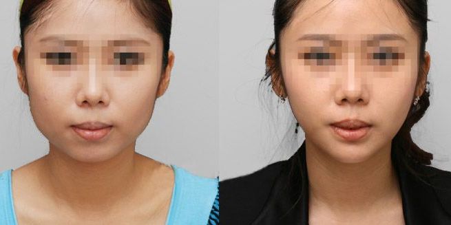 蘭州哪家整形醫(yī)院口碑好？看看排名榜單！