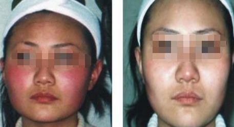 蘇州雙眼皮醫(yī)院排行榜，哪所醫(yī)院技術(shù)靠譜