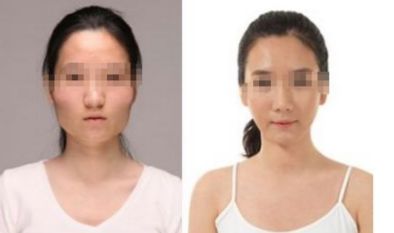 2024年臺州地區(qū)優(yōu)秀整形醫(yī)院推薦