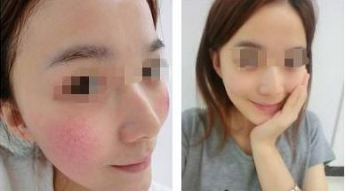 福州哪里有好的紋眉整形醫(yī)院值得推薦